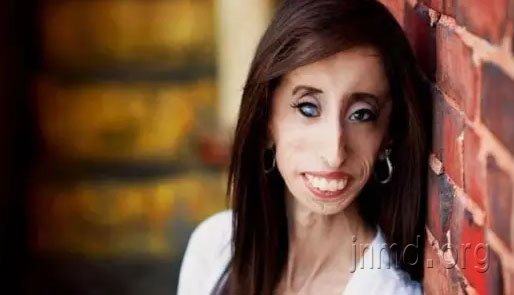 “世界上最丑女人”的美丽人生