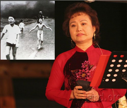 越战照片女孩金福：逃出伤疤